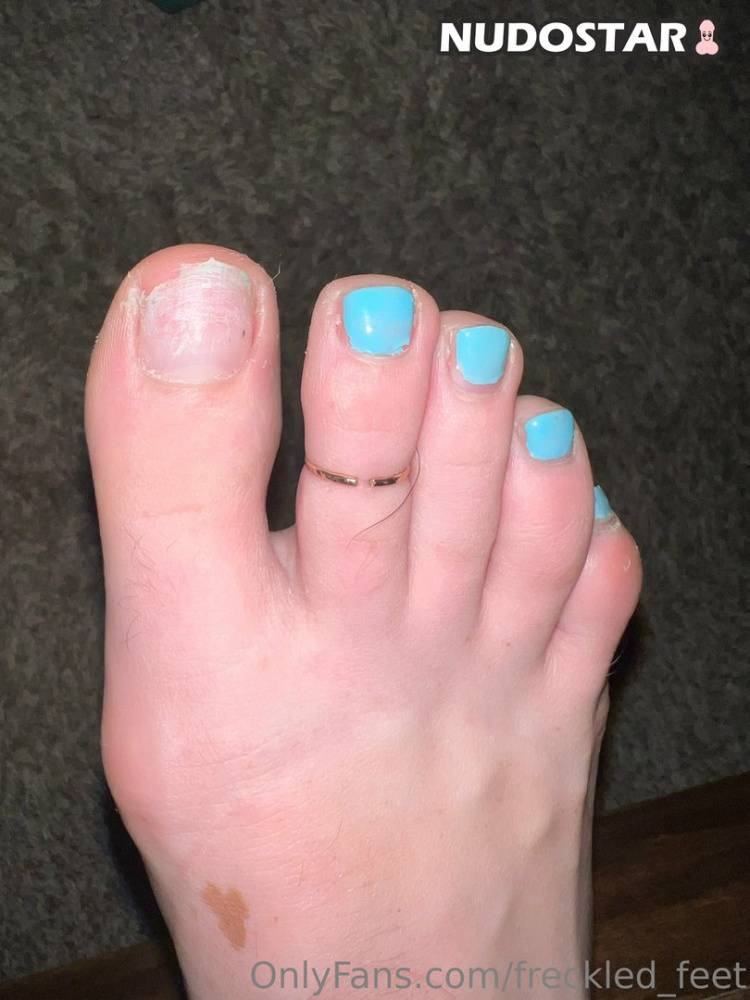Freckled Feet OnlyFans Leaks - #2